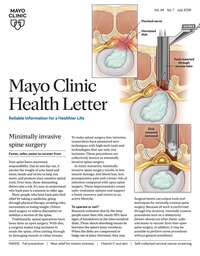 coverImage